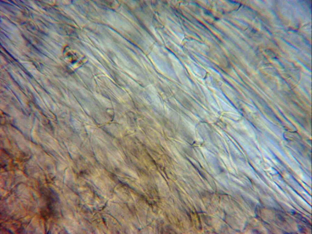 10 - Subpellis frontal x 1000 agua